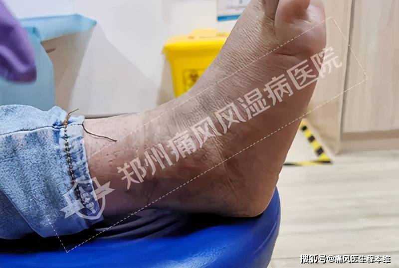 快手怎么举报主播？一站式操作指南